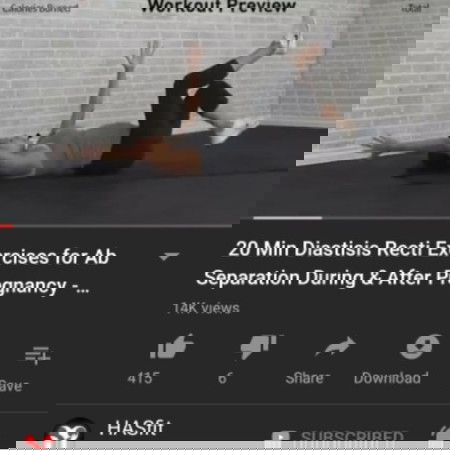 Diastisis Recti Pre and Post natal workout