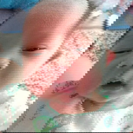 ตุ่มใสๆ.