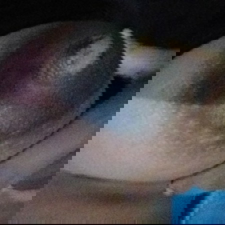 คุณแม่คนไหนมีปันหาเรื่องหัวนมบ้างคร่า