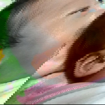 lekukan di telinga bayi