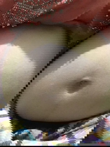 สะดือแบบนี้ท้องลูกสาวหรือลูกชายคะ