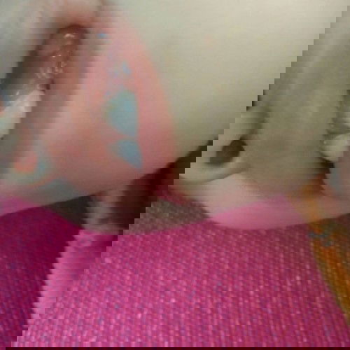 มีเหงือกบวม