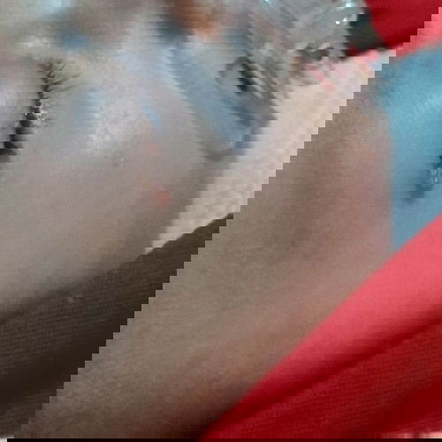 merah dipinggir mata