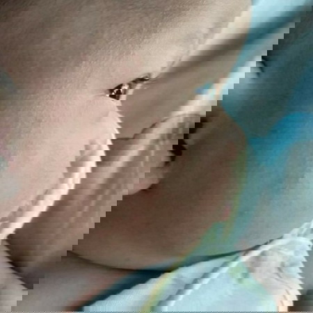 ลูกเป็นผดผื่นแม่ๆมีวิธีรักษาอย่างไงค่ะ