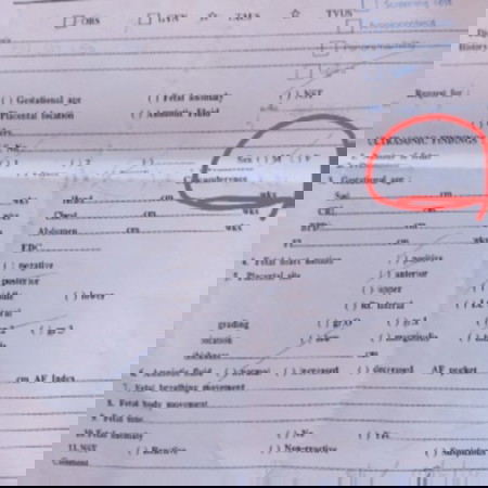ถามแม่ๆค่ะ