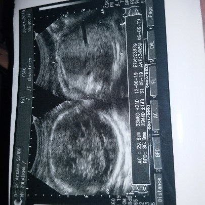 hasil usg