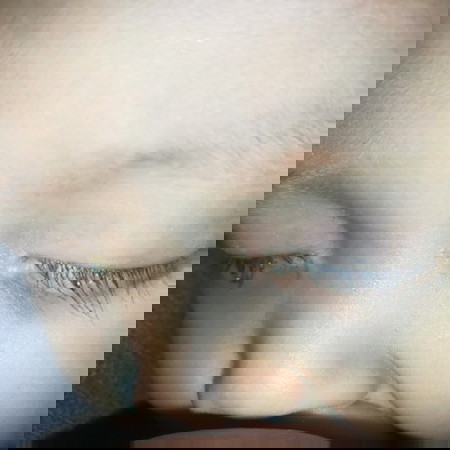 อยากทราบอาการที่เป็น