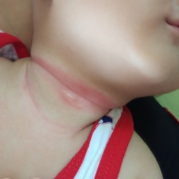 คอน้องแดงๆ