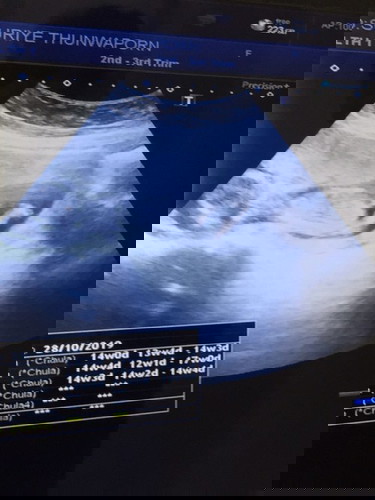 ได้ล฿กชาย