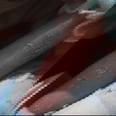 bintik merah