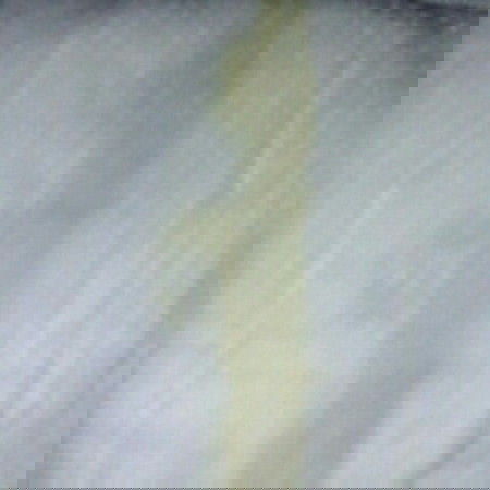 Yellow discharge