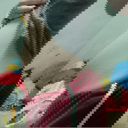 ท้องได้10wแล้วกังวลหน้าท้องไม่ออก