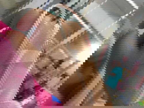 เลือดไหลในช่องคลอด