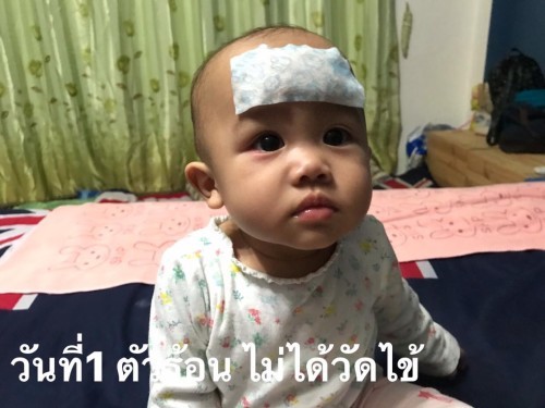 ไข้หวัดไวรัส คือ หัด นะคะ