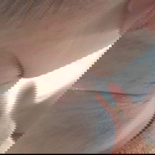 ลูกแพ้เหงื่อใช้ยาอะไรทาได้บ้างคะ