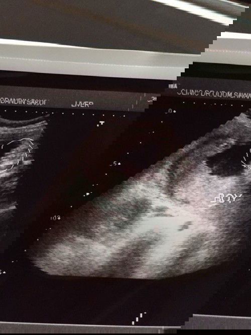 ดูเพศช่วยหน่อยคะ