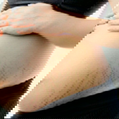 Stretch Marks (A poem I wrote for every mom out there)