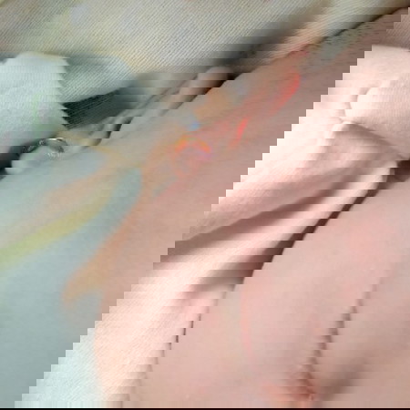 tentang bintik di wajah