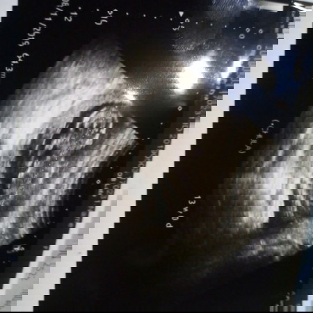 *อัลตร้าซาวด์1*