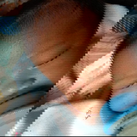 อันนี้ใช่ผดร้อนหรือเปล่าคะ