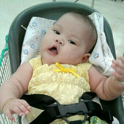 ลูกคอเอียงซ้ายทำไงดี