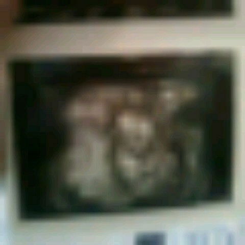 support system bunda