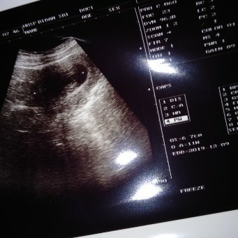 3bulan bayinya kecil