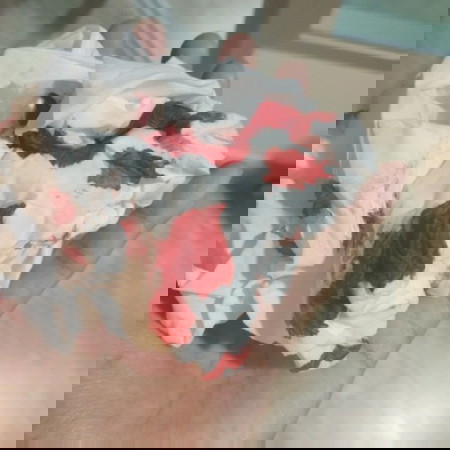 เลือดกำเดาไหล