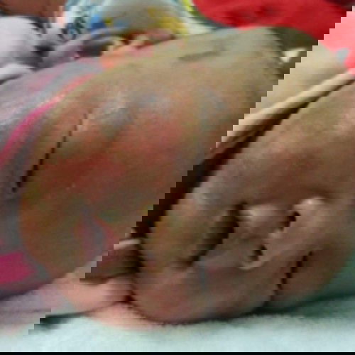 บัานไหนเคยเป็นแบบนี้บ้างครับ