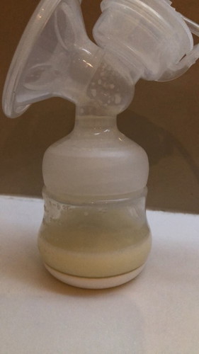 น้ำนมหด