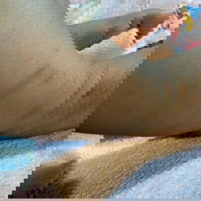 รอยดำจากยุงกัด