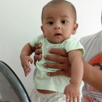 rambut botak