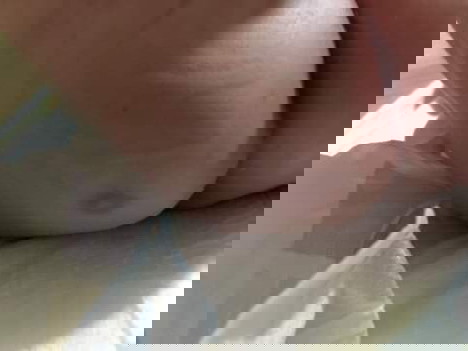 Skin rashes