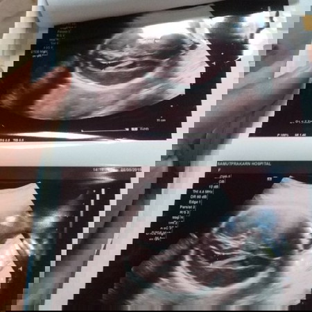 28สัปดาห์แล้วค่ะ ไปซาวมายังดูไม่ออกเลยค่ะ