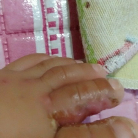 kulit kaki