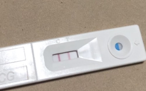 รู้สึกเจ็บหน้าอก