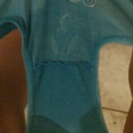 Amniotic fluid leakage