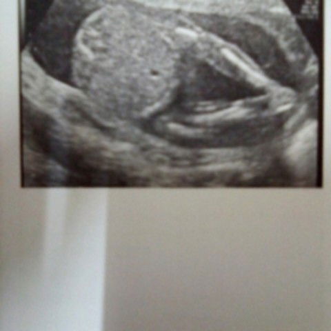 ดูไม่ออกว่าหญิงหรือชายหมอไม่บอกจ้า