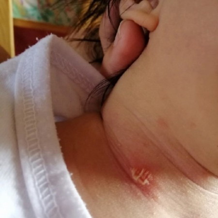 Something Sa Neck