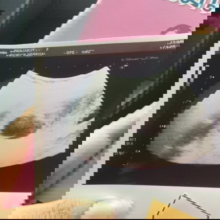 แบบนี้มีตัวเด็กไหมค่ะ