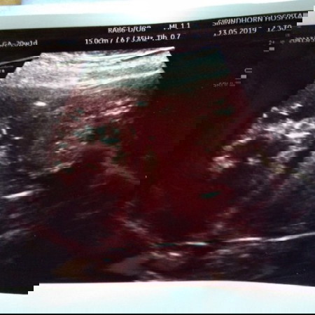 มองยังไงก็มองไม่เป็น