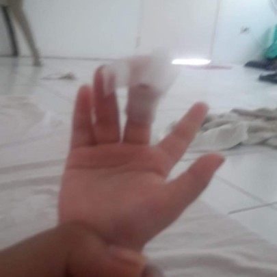 Natangal ung kuko ng baby ko