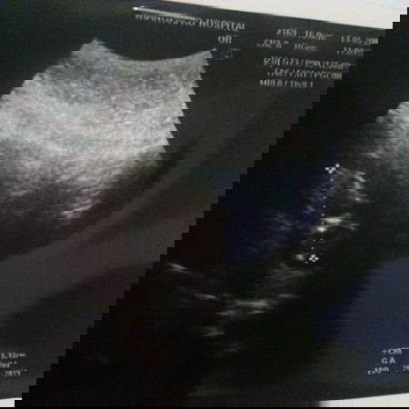 12 สัปดาห์ ?