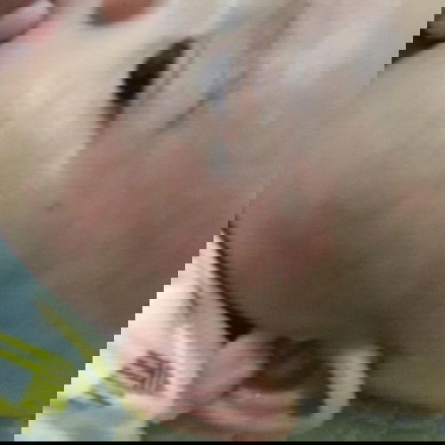 kulit memerah, kering, dan menebal