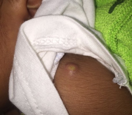 เป็นแบบนี้ทำไงถึงหายค่ะ