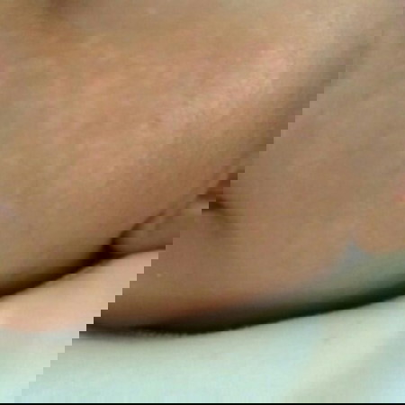 bercak putih di wajah bayi