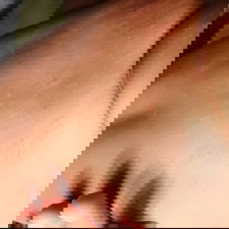 น้องเป็นเผื่อนเเดงทั้งตัว