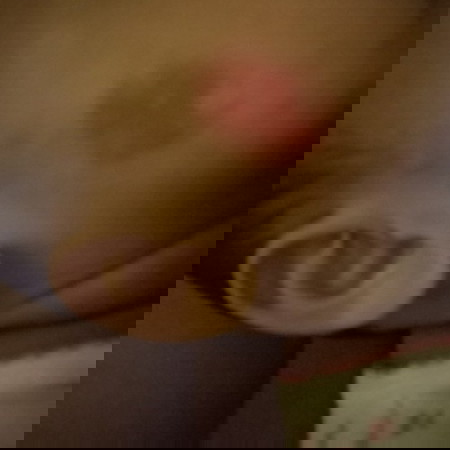 น้องๆบ้านไหนเคยเป็นบ้างไหมค่ะ