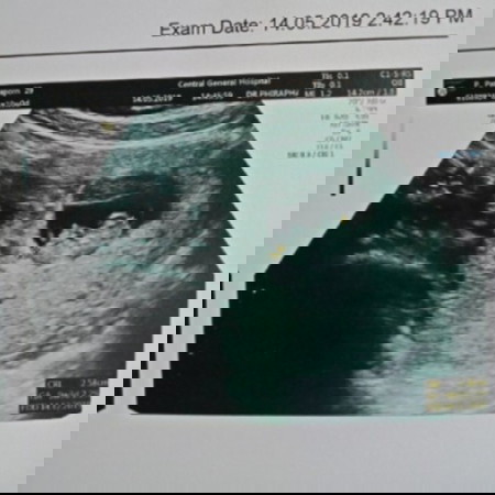 9w3d จ้าาา ขอดูหน่อย