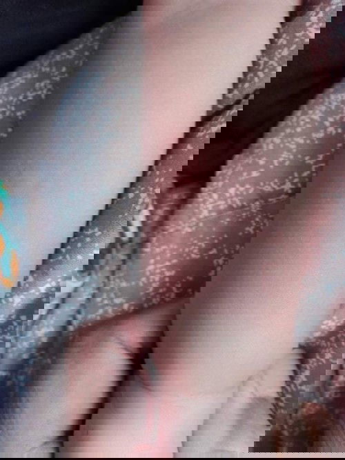 สอบถามเรื่องผื่นแดง